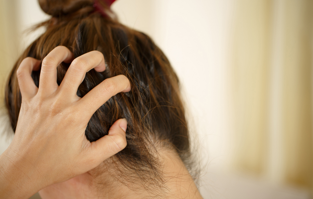 Sensitive Scalp What You Need To Know & How To Treat It Wellsen