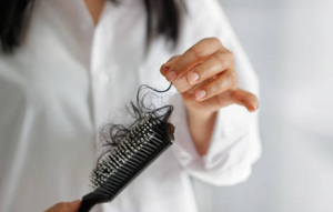 An asian woman facing hair loss