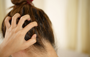 A woman has sensitive scalp