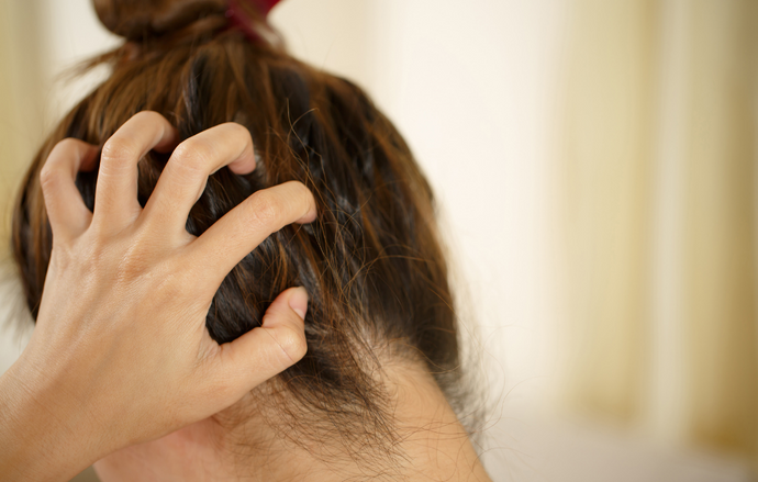 Sensitive Scalp: What You Need To Know & How To Treat It