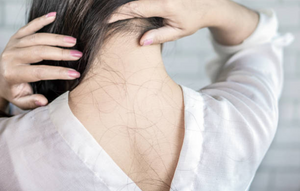 Asian woman hair loss